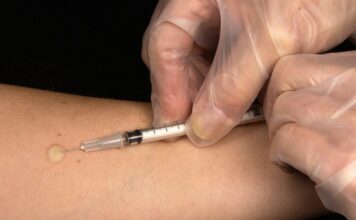 วัคซีนกันโรคหัด