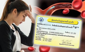 บัตรทองเพิ่มสิทธิรักษาด้วยการสวนหลอดเลือดสมอง