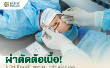 ผ่าตัดต้อเนื้อ ไม่ใช่เรื่องอันตรายอย่างที่คุณคิด