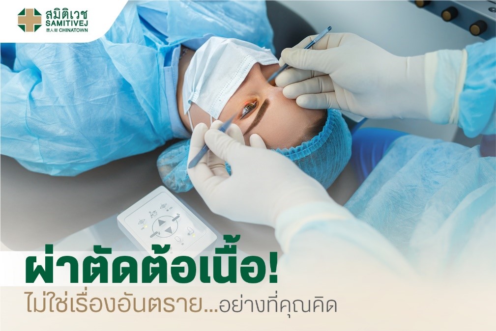 ผ่าตัดต้อเนื้อ ไม่ใช่เรื่องอันตรายอย่างที่คุณคิด