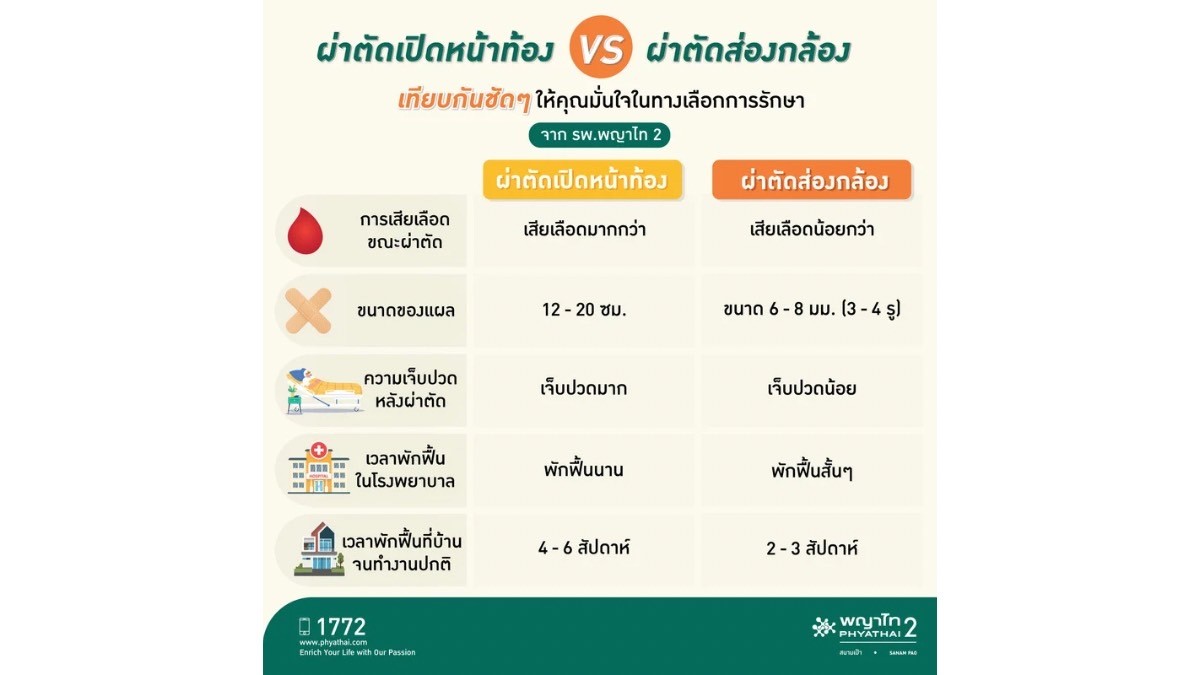 รพ.พญาไท 2 ชูเทคโนโลยีนวัตกรรมผ่าตัดผ่านกล้องชั้นสูง