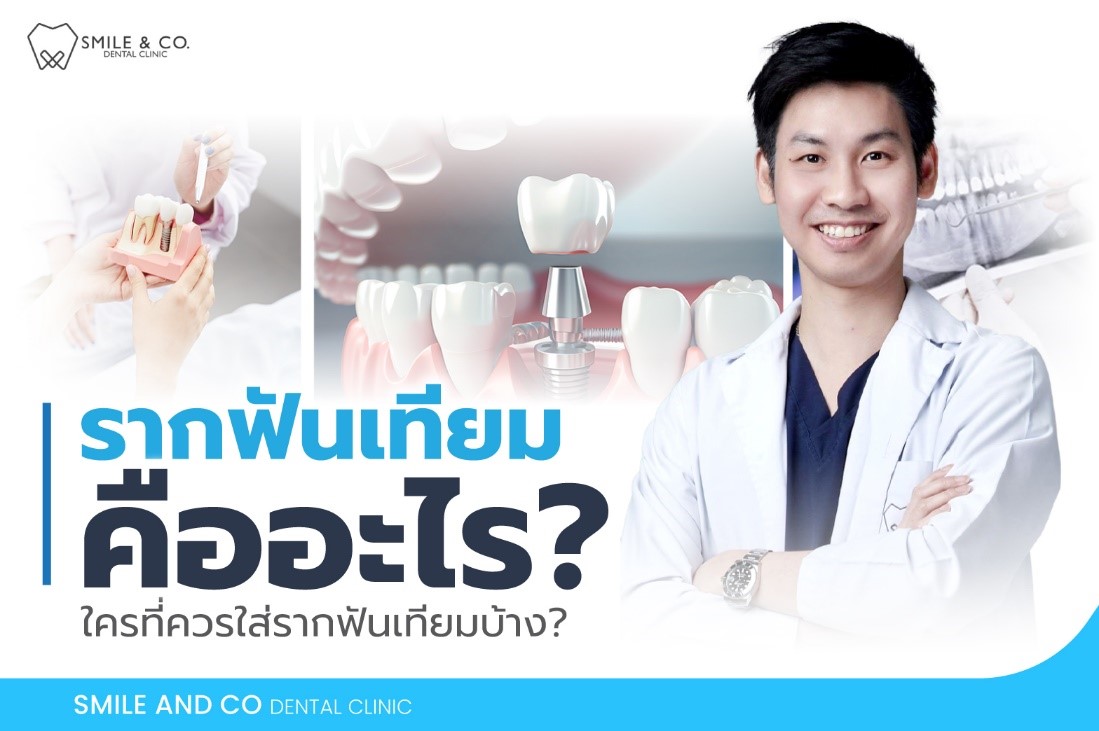 รากฟันเทียม ทันตกรรมรักษารากฟัน ช่วยเติมเต็มสุขภาพของฟันให้กลับมาแข็งแรง