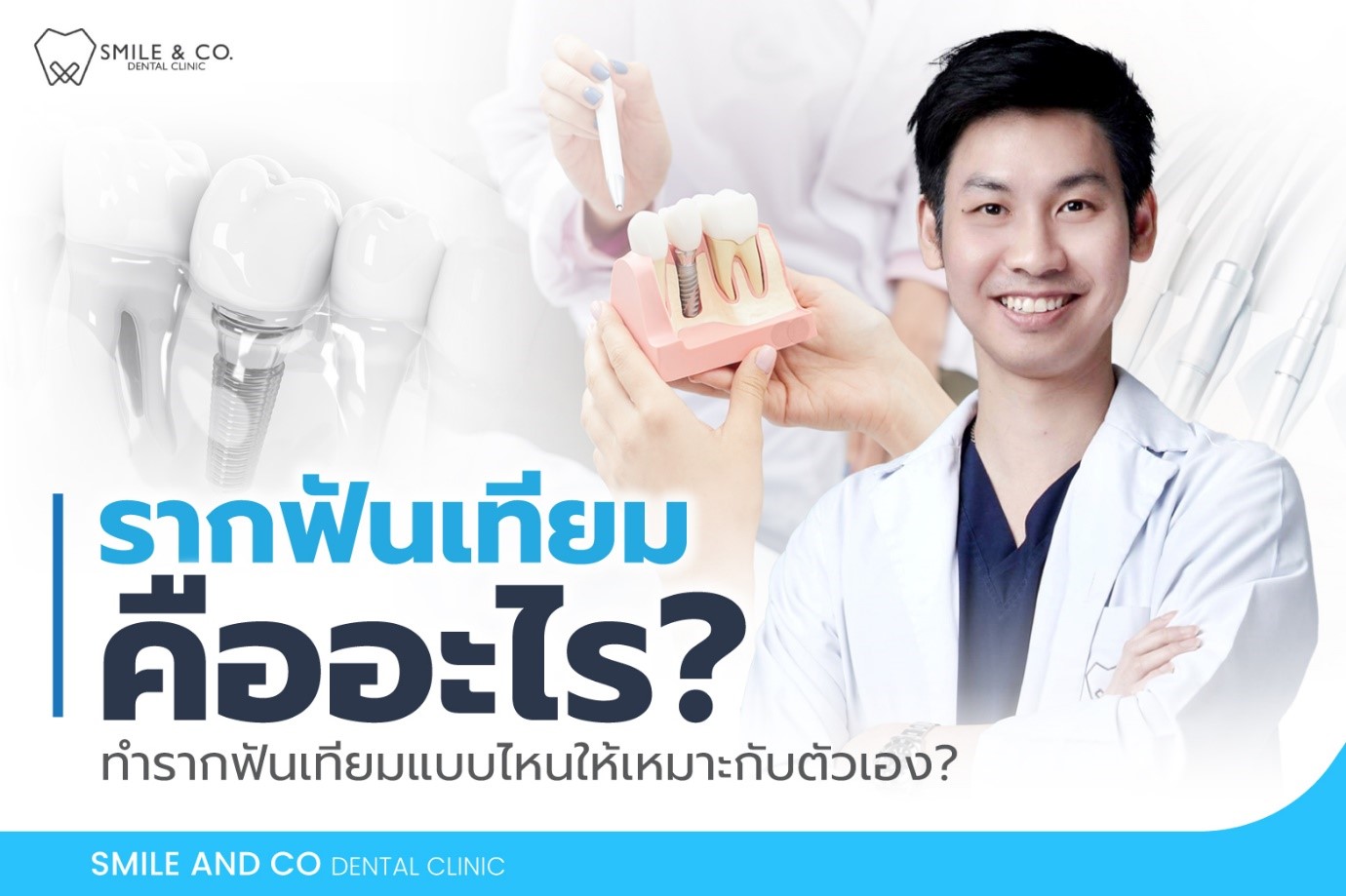 รากฟันเทียมแบบไหนเหมาะกับคุณ รู้จักประเภทของรากเทียม เลือกอย่างไรให้คุ้มค่า