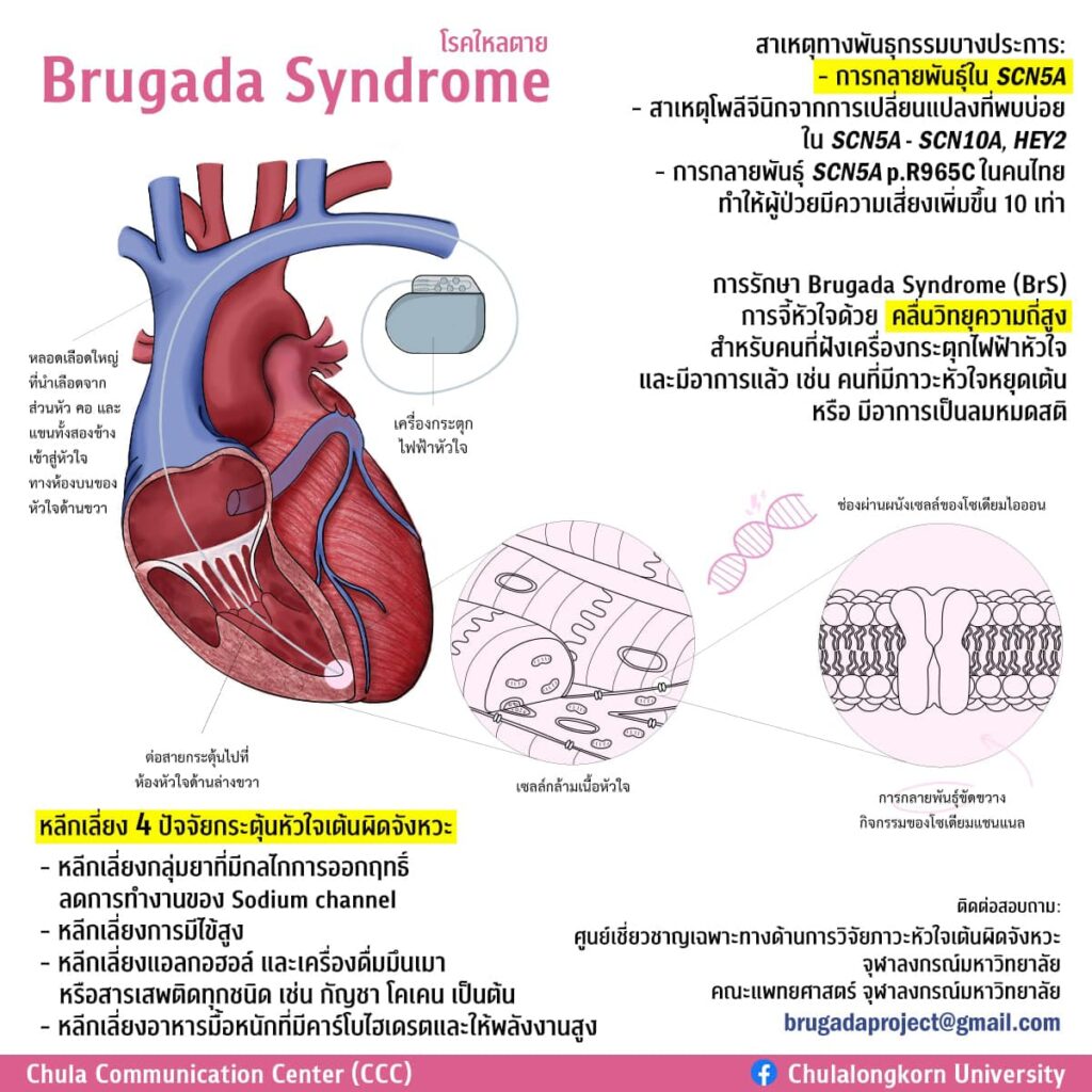 หมอมนูญ เปิดสาเหตุโรคไหลตาย ชี้มักเกิดกับชายหนุ่มที่แข็งแรง