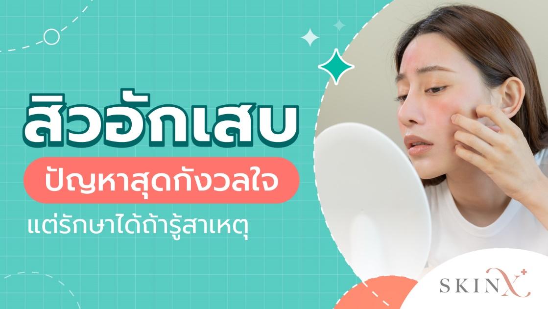 สิวอักเสบ รู้สาเหตุ สู่วิธีรักษาที่เหมาะสม