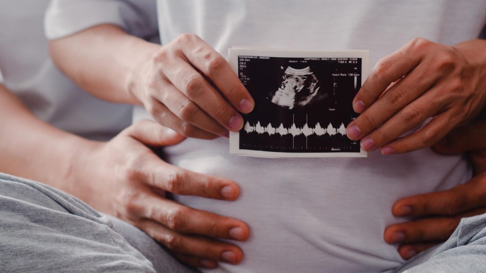 In-Vitro Fertilization