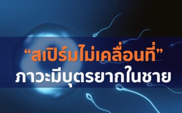 “สเปิร์มไม่เคลื่อนที่”