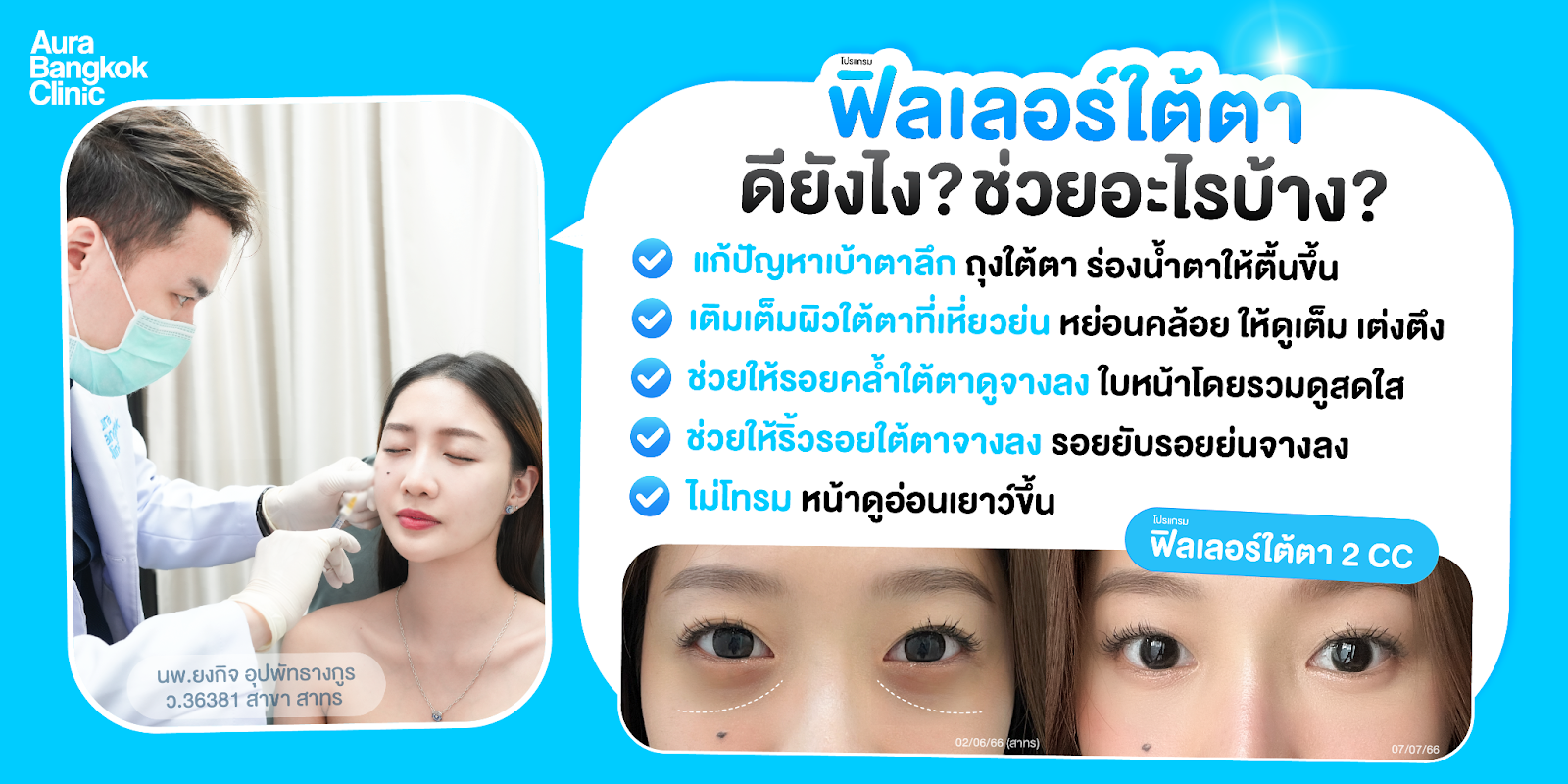 เติมใต้ตา