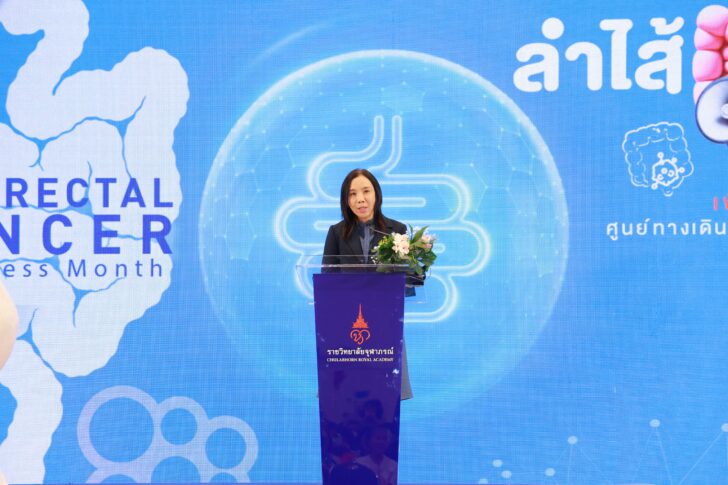 Julaphorn Hospital รพ.จุฬาภรณ์ รณรงค์ลดการป่วยโรคมะเร็งลำไส้ของคนไทย