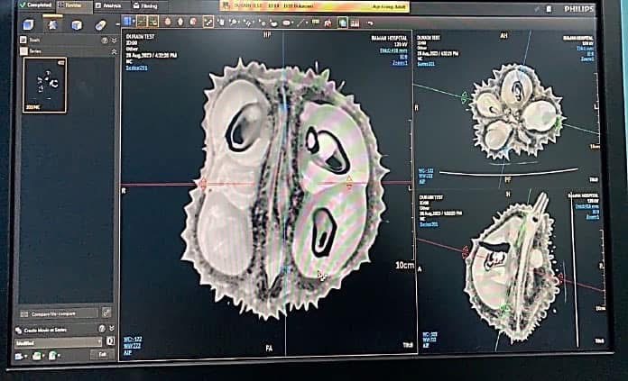  "ARDA" สร้างเครื่อง CT-Scan ทุเรียนสุดล้ำประมวลผลด้วยระบบ AI คัดทุเรียน