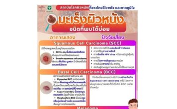 สถาบันโรคผิวหนัง กรมการแพทย์ โดยมะเร็งผิวหนังชนิดที่พบได้บ่อย