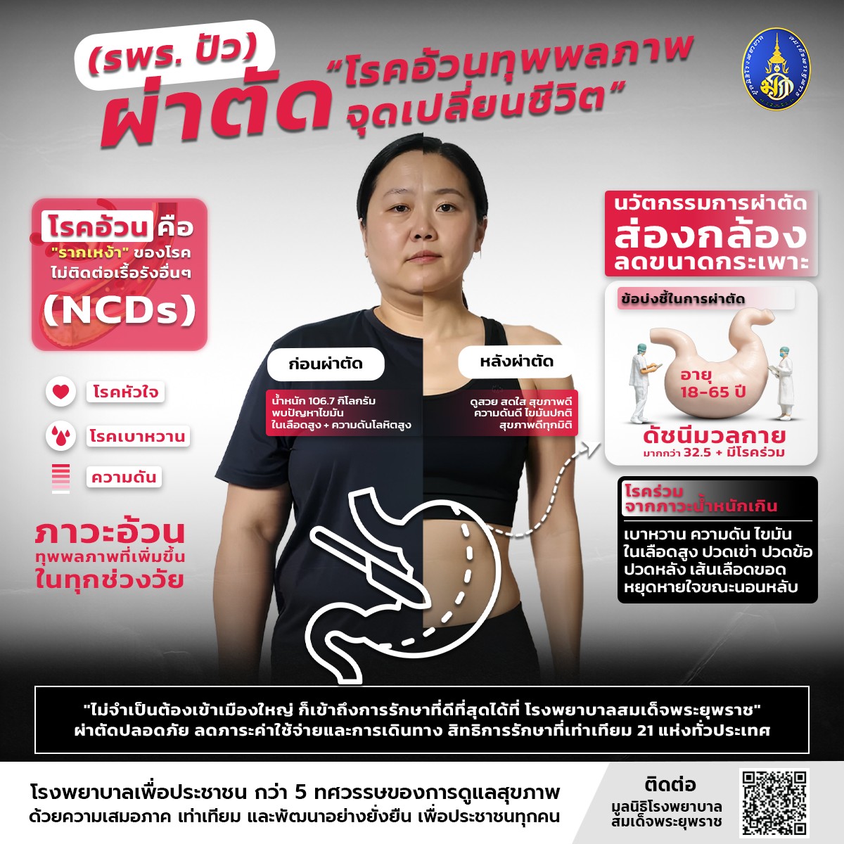 ข่าวดี!!! สำหรับผู้ป่วยโรคอ้วน
